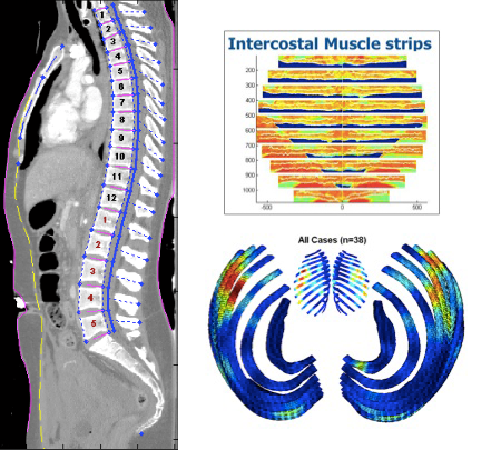 Computational Biomechanics